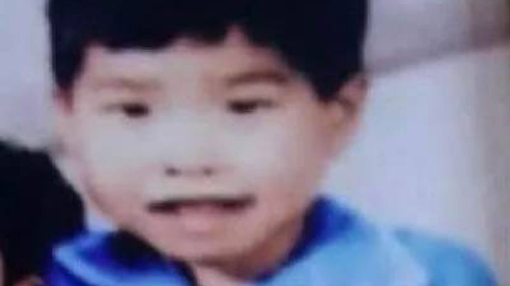 0 North Korean defector was left homeless as child and bedbugs made him look like torture victim