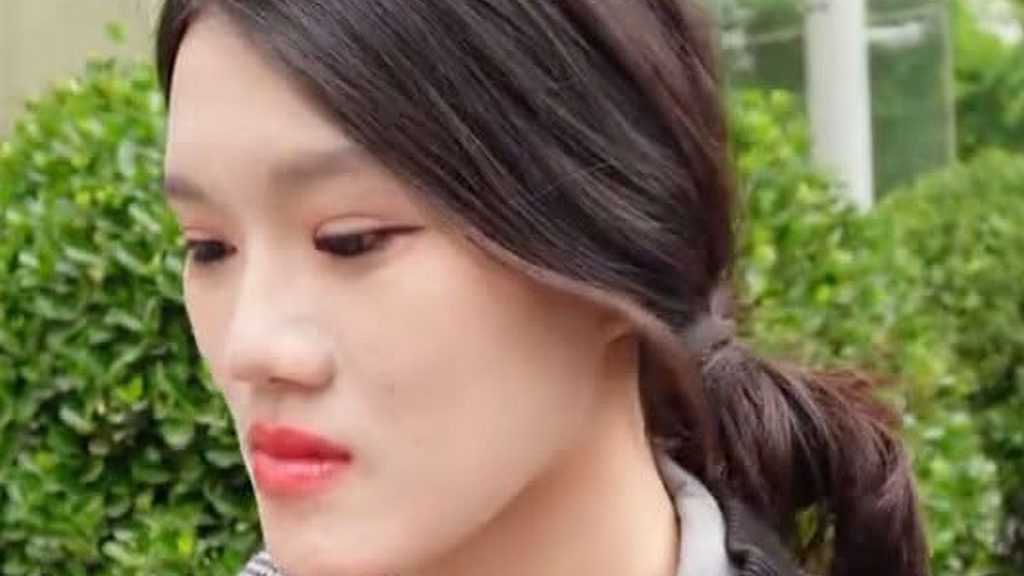 0 Woman left deformed and unable to breathe after botched face surgery