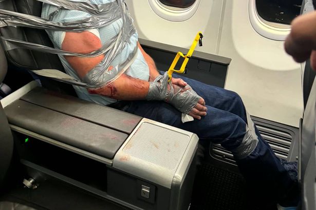 0 An individual is seated on a bench secured with multiple straps around their body possibly as a safety precaution The